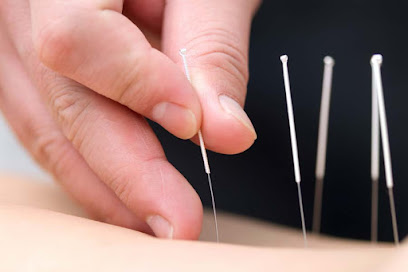 Fabrikia Acupuntura en Vergara. Clínica de acupuntura